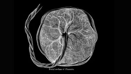 Old engraved illustration of human placenta on a black background