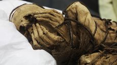The mummy &mdash; the remains of a male between 18 and 22 years old &mdash; was found buried in a fetal position in a tomb at the site of Cajamarquilla in Peru. 