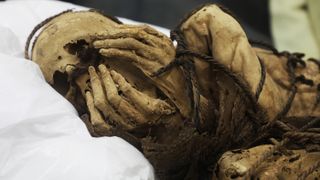 The mummy — the remains of a male between 18 and 22 years old — was found buried in a fetal position in a tomb at the site of Cajamarquilla in Peru. 