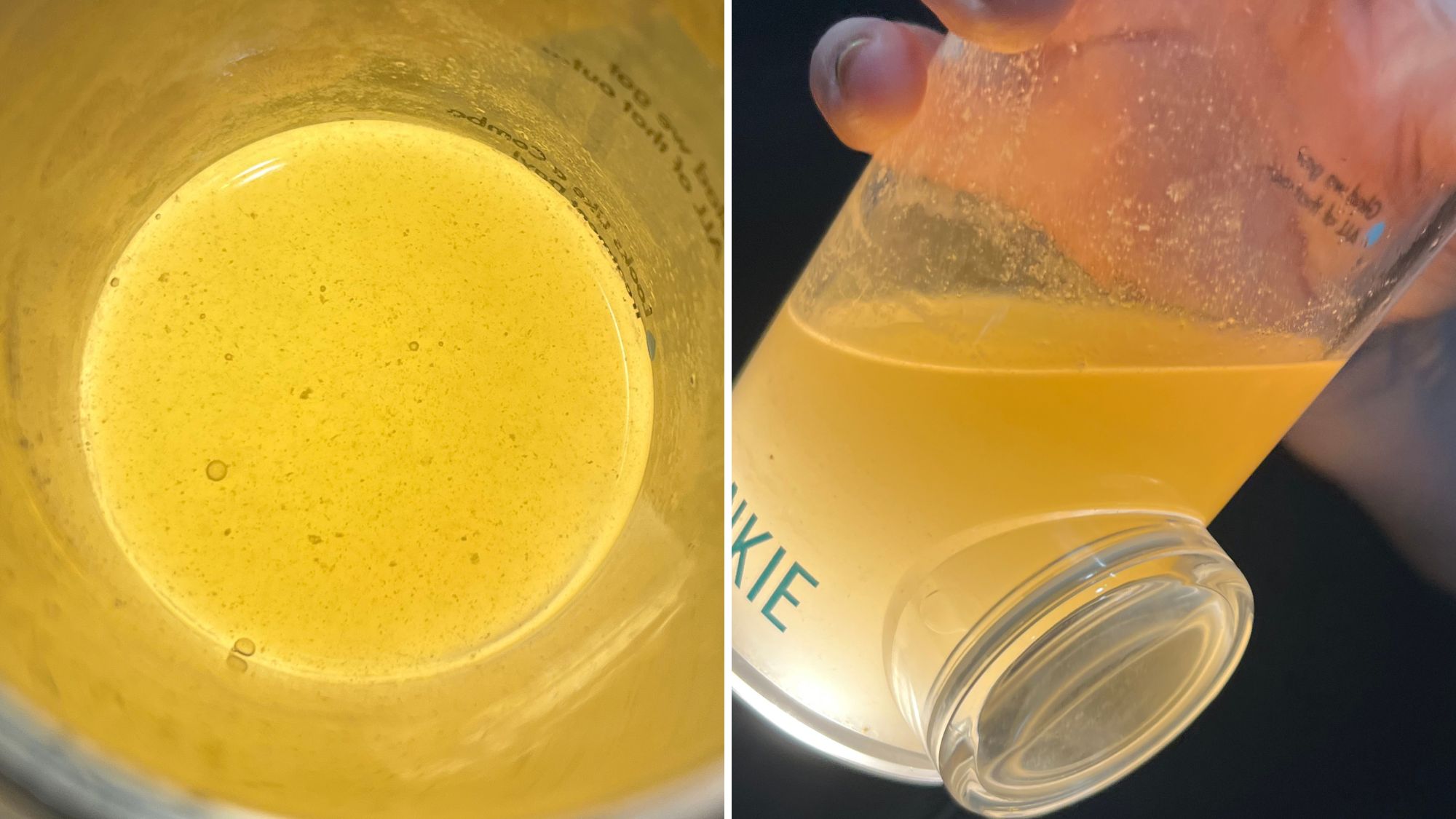 Keravive Hydrafacial Gunkie results
