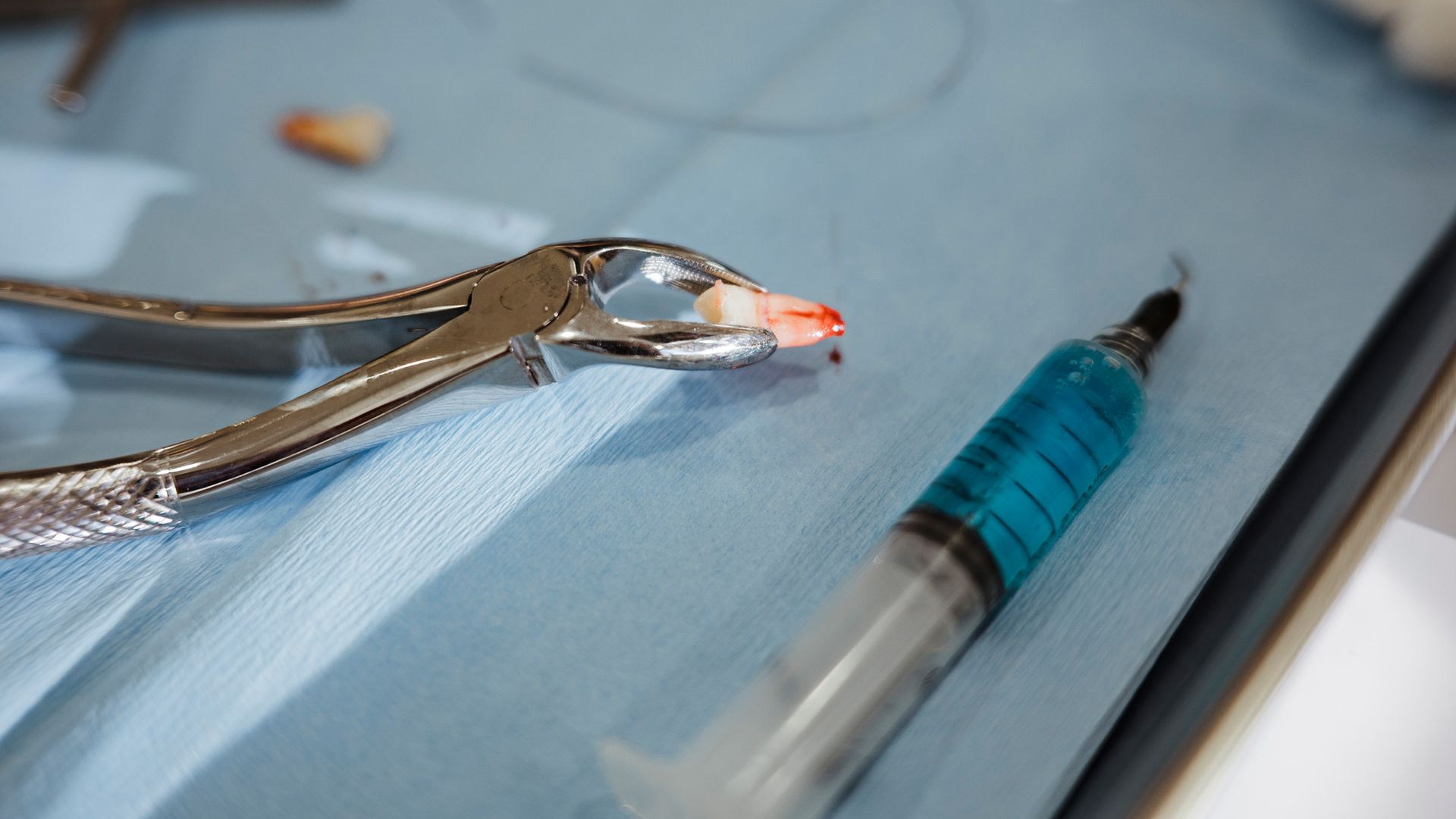 Weird spikes poking through a teen's eyelid turned out to be a wayward tooth