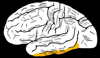 Brain diagram with inferior temporal gyrus highlighted in yellow.
