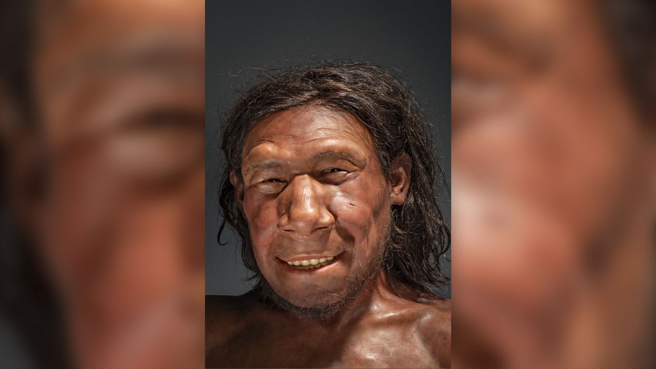 The Neanderthal, nicknamed Krijn, had a benign tumor above his right eyebrow.