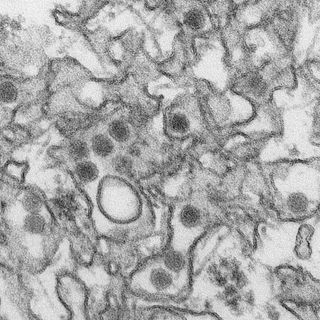 This is image of the Zika virus was taken using a transmission electron microscope. The virus particles are 40 nanometers in diameter, with an outer envelope, and an inner dense core.