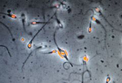 A new test that checks a man&#039;s sperm count will soon be available in the UK