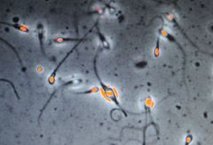 A new test that checks a man's sperm count will soon be available in the UK