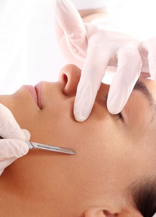 Dermaplaning