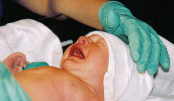 Steroids That Help Preemies Breathe May Harm Their Brains Live Science