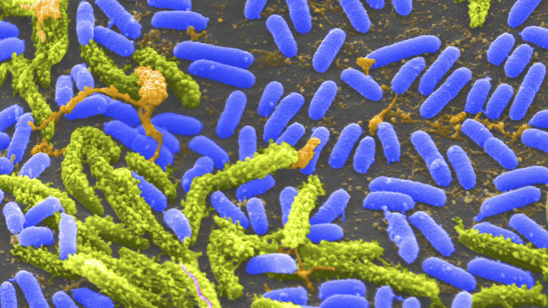 A microscope image of rod-shaped Vibrio bacteria