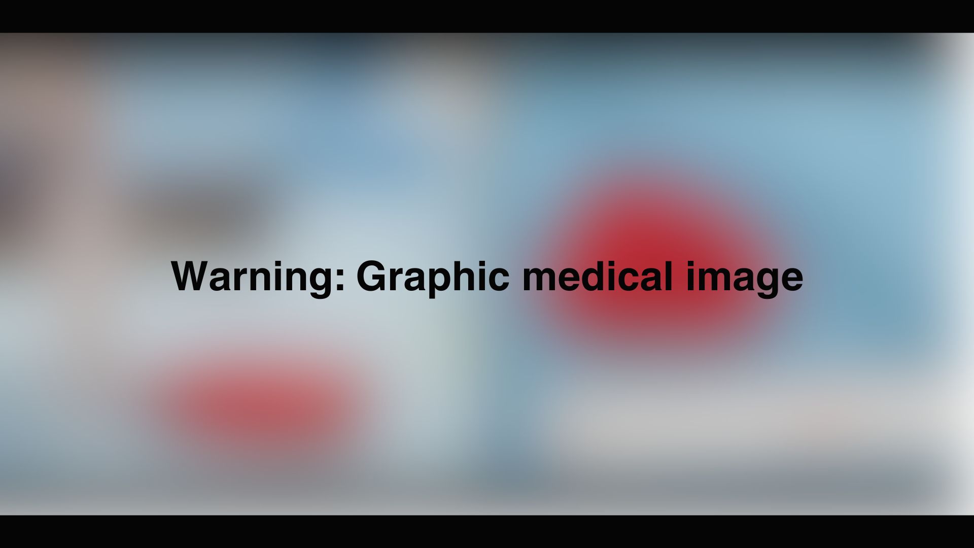 Text reads: Warning: Graphic medical image, in front of a blurred background