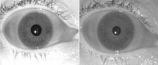 A sample iris image acquired with LG 4000 iris sensor in March 2008 (left) and again in March 2011 (right).