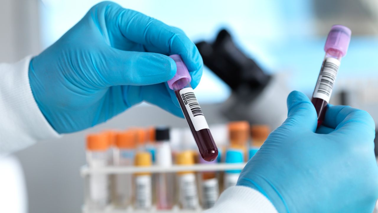 Hand holding blood sample in laboratory