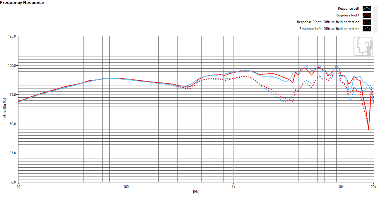 Frequency response