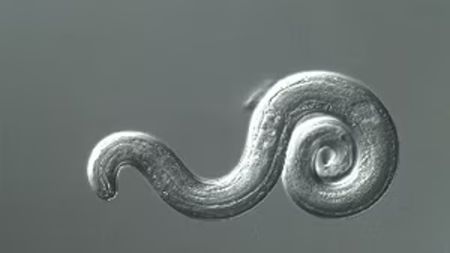 Image of the rat lungworm parasite