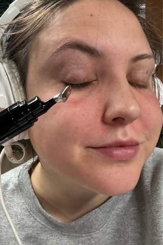 Sophia Vilensky holding up the revision eye cream applicator near her left eye