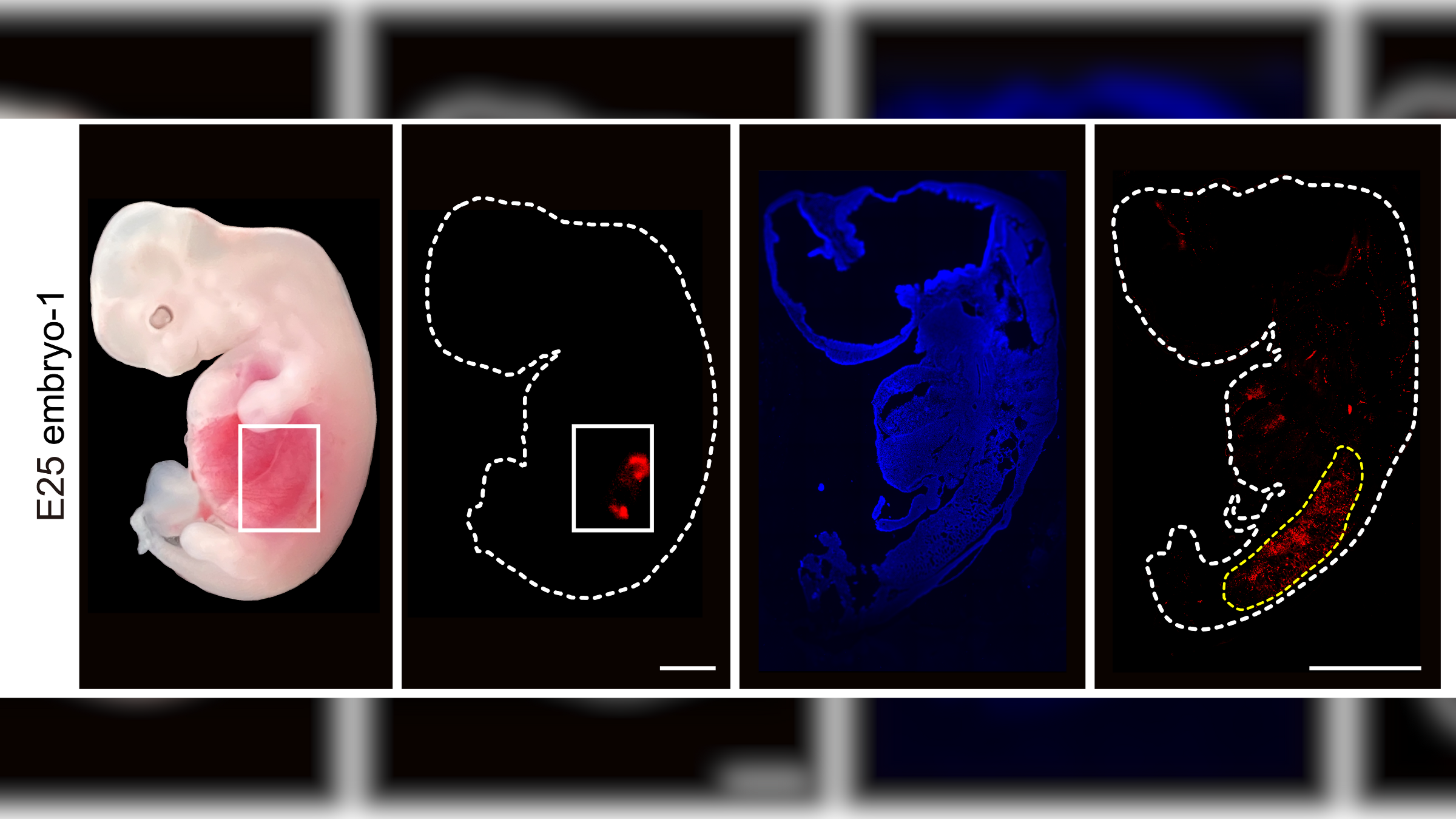 In a 1st, scientists grow human kidneys inside developing pig embryos ...