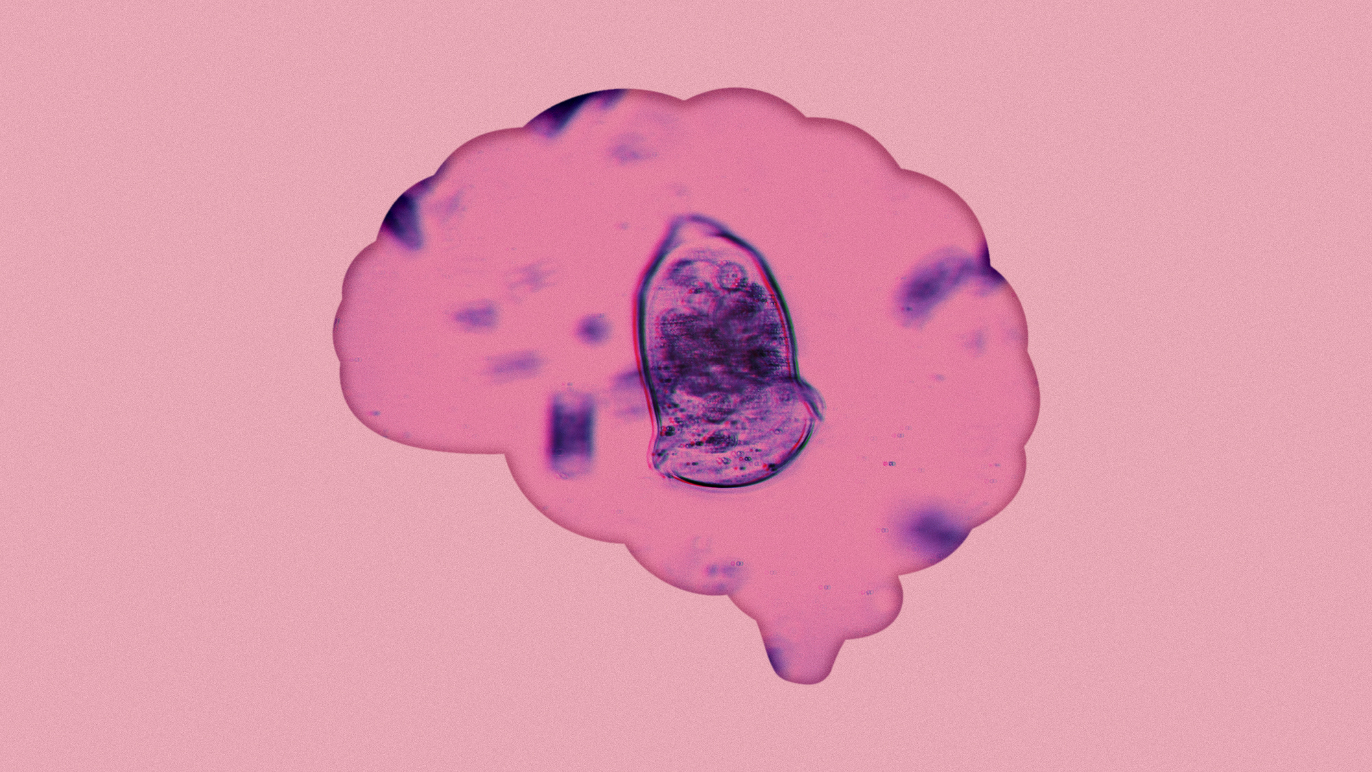 Illustration of a brain silhouette filled with a microscopic view of an amoeba