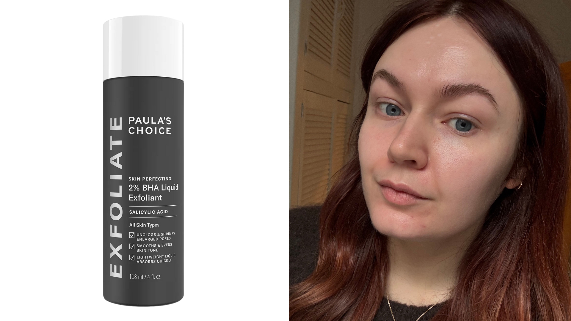 On the left, PAULA&#039;S CHOICE Skin Perfecting 2% BHA Exfoliating Toner and on the right, an image of Lucy Abbersteen with makeup-free skin