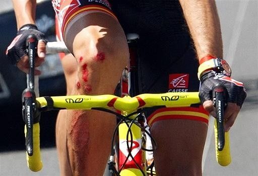 The Spaniard sustained abrasions to his right side but finished the stage without losing time.