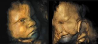 Fetal facial expressions develop in the womb