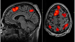 fMRI shows blood flow in a brain during a memory test