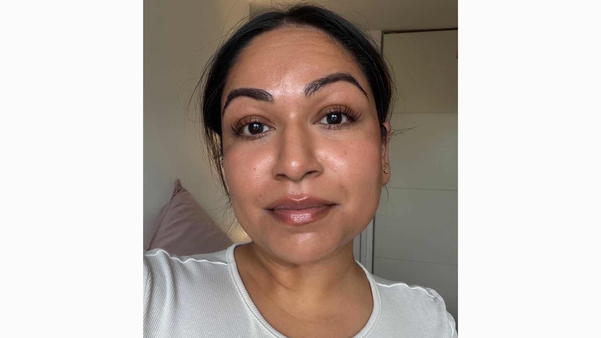 Aleesha's skin after new skincare routine