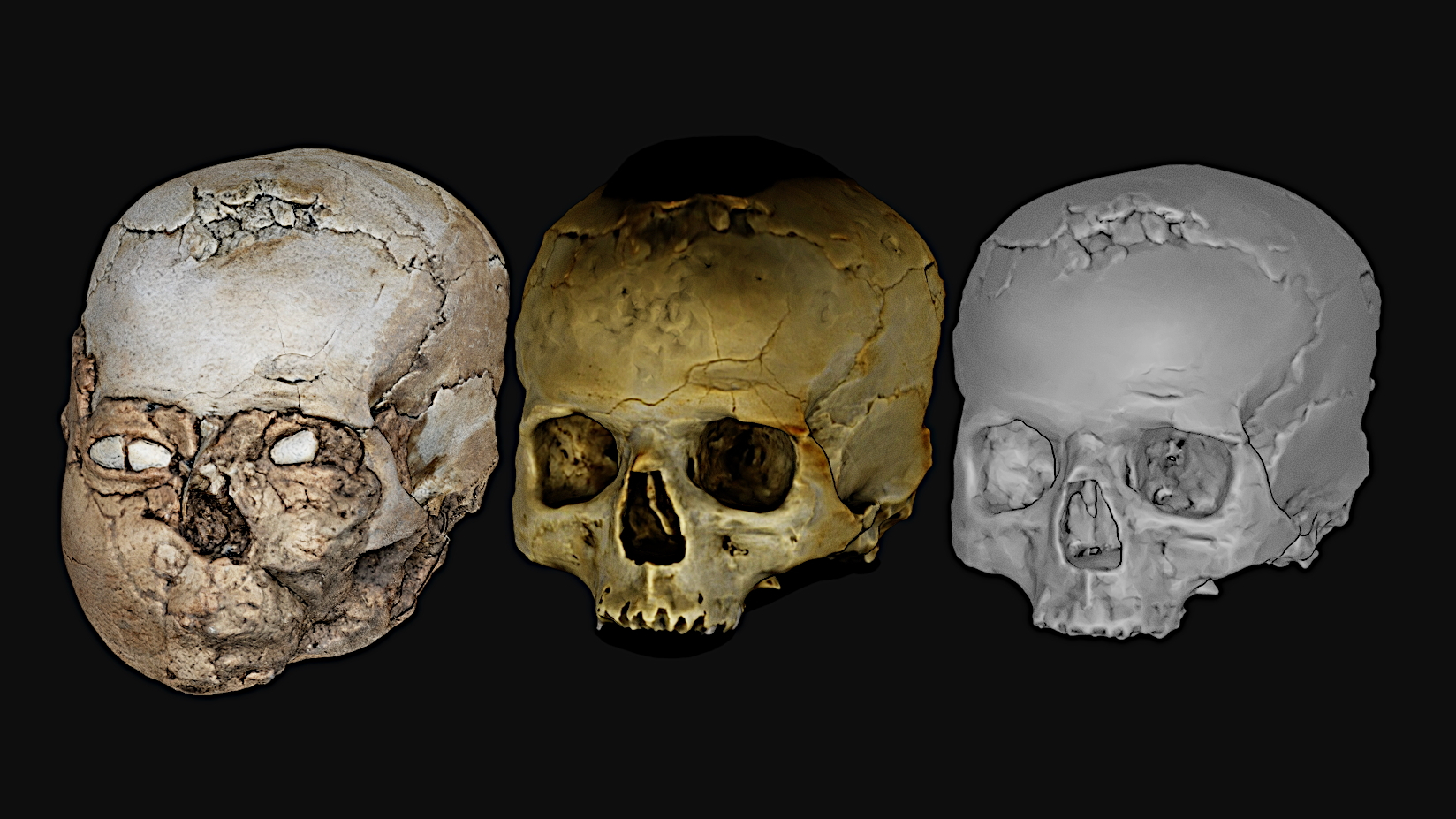 three skulls shown side by side; the far left skull has shells in its eye sockets and some rock obscuring the features of the nose and mouth. The other two skulls show the skull without the shells or rock