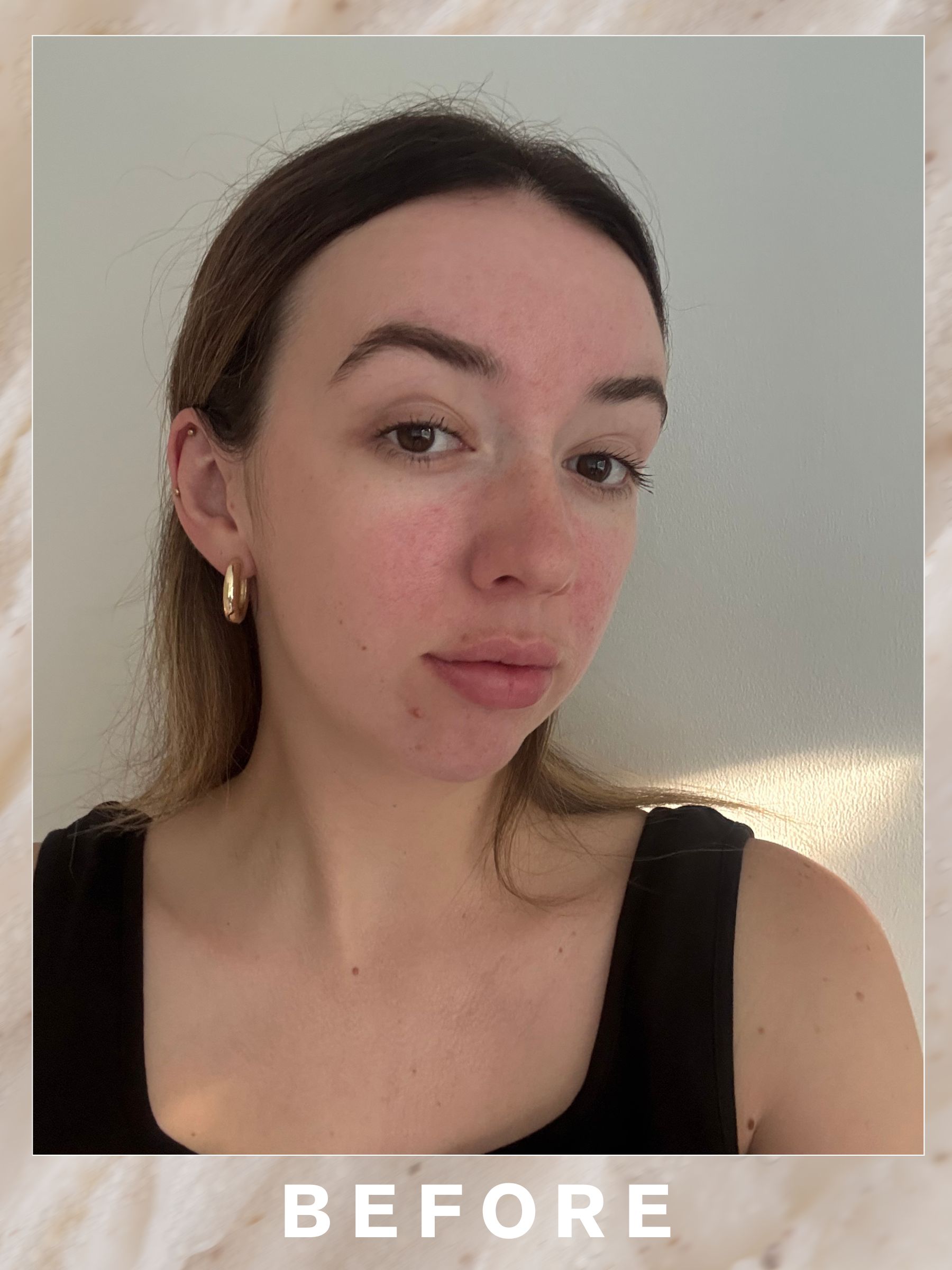 Megan before her Oskia Signature Glow Facial