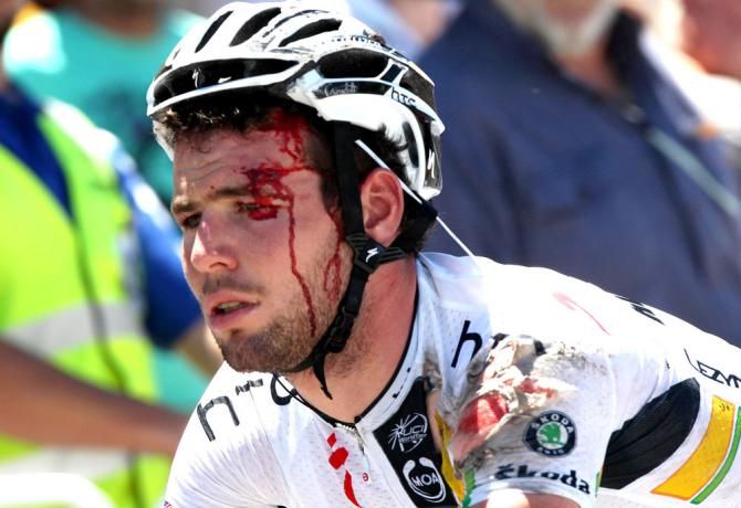 Mark Cavendish had a heavy fall at the Tour Down Under in 2011