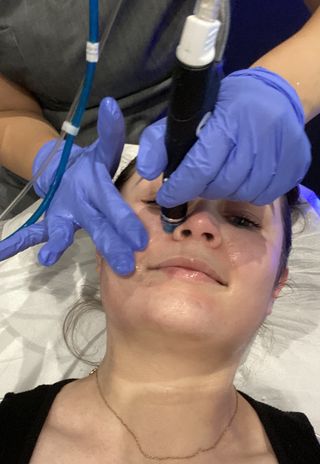 Lucy during the Hydrafacial