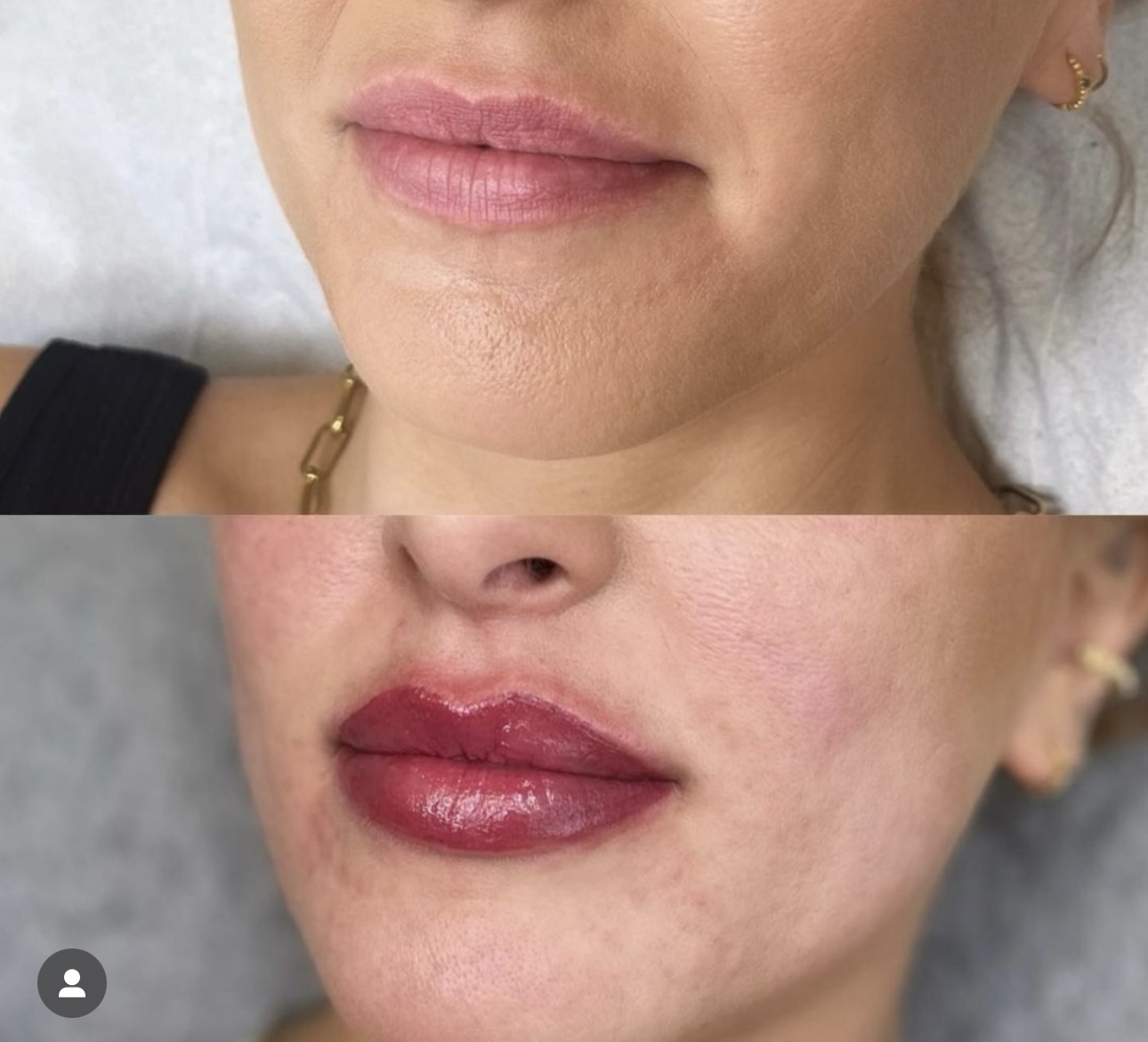 Lip Blush before and after