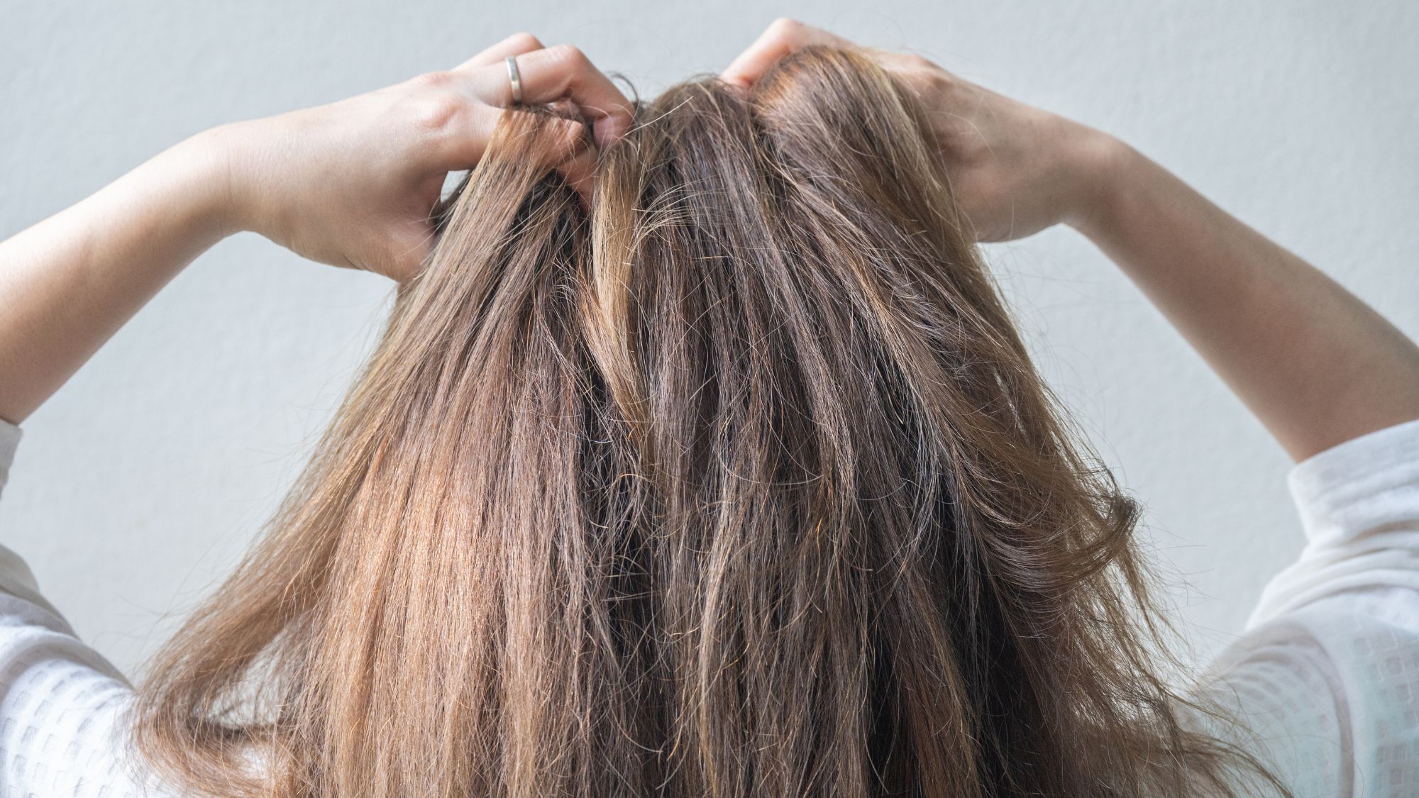 Woman scratching her itchy scalp