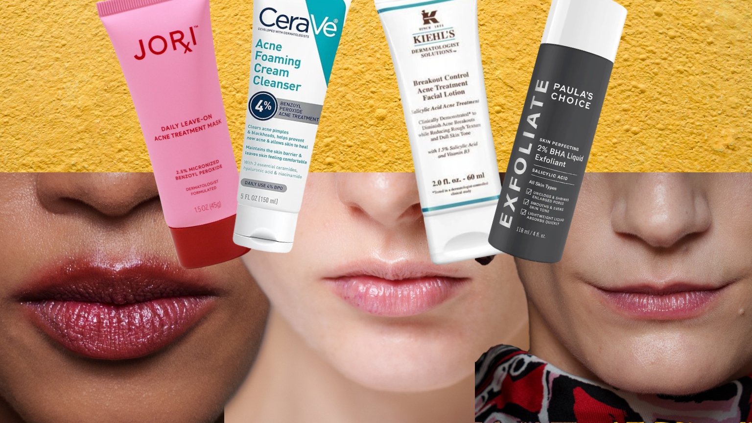 a collage of three women's mouths close up over a bumpy yellow background with bottles of skincare for hormonal acne products at the top