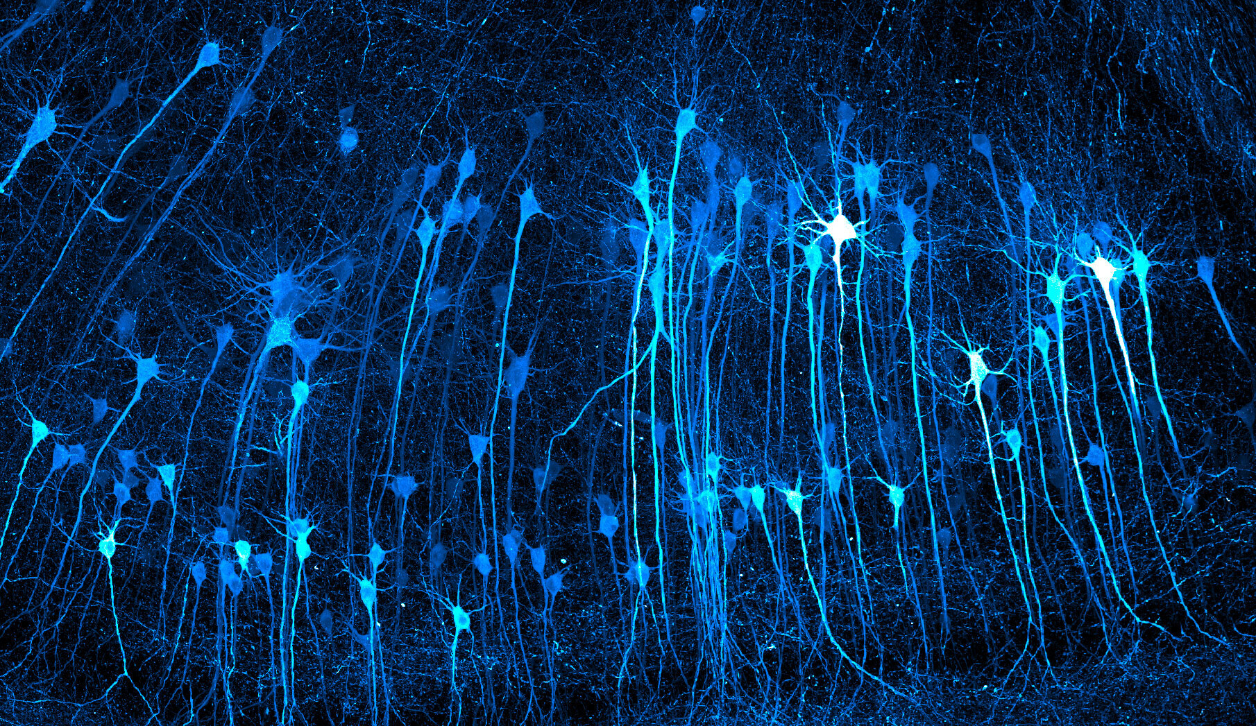 Dozens of glowing blue neurons against a black background, their teardrop-shaped cell bodies trailing long, thread-like branches that run vertically through the frame like a forest of tangled trees.