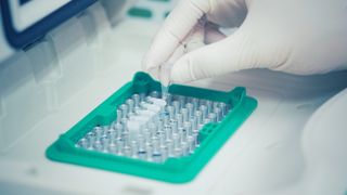 PCR tests being prepped