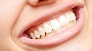 How Many Teeth Do Humans Have? image shows smile