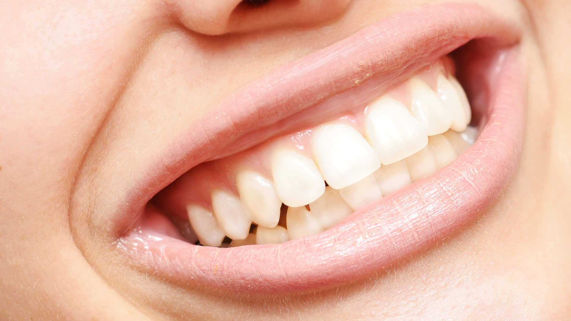 largest human teeth in the world