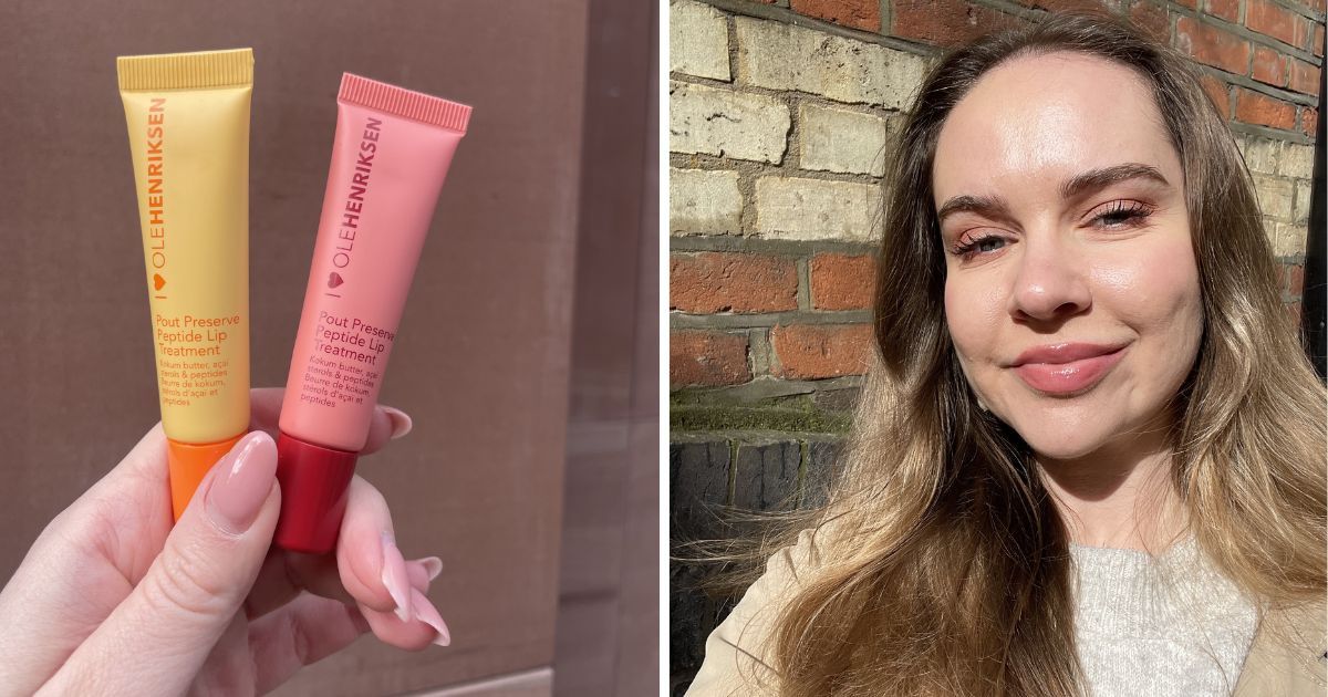 Polynucleotide Injections For Dark Circles, Reviewed INOVAREPRODUCTS