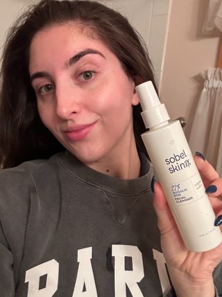 Marisa's skin after using the Sobel Skin Rx 27% Glycolic Acid Facial Cleanser