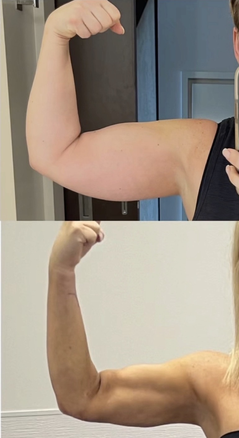 a before and after image of a white woman's arms