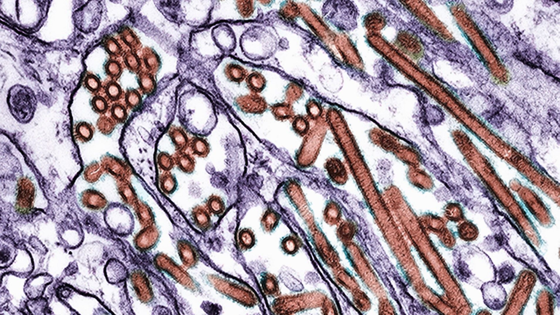 Today’s biggest science news: Man dies from H5N5 bird flu | ‘Alien’ rock on Mars | ‘Other’ comet ATLAS disintegrating Today’s biggest science news: Man dies from H5N5 bird flu | ‘Alien’ rock on Mars | ‘Other’ comet ATLAS disintegrating