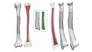 An illustrated diagram of the bones seen from different angles