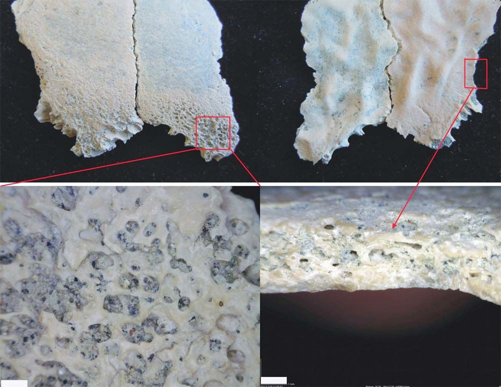 A fragment of a child&#039;s skull discovered at Olduvai Gorge, Tanzania, shows the oldest known evidence of anemia caused by a nutritional deficiency.