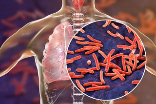 3D image of tuberculosis bacteria.