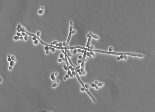 Photomicrograph of the hyphal form of the fungal pathogen Candida albicans. Taken with a phase-contrast microscope and Normarski optics. 