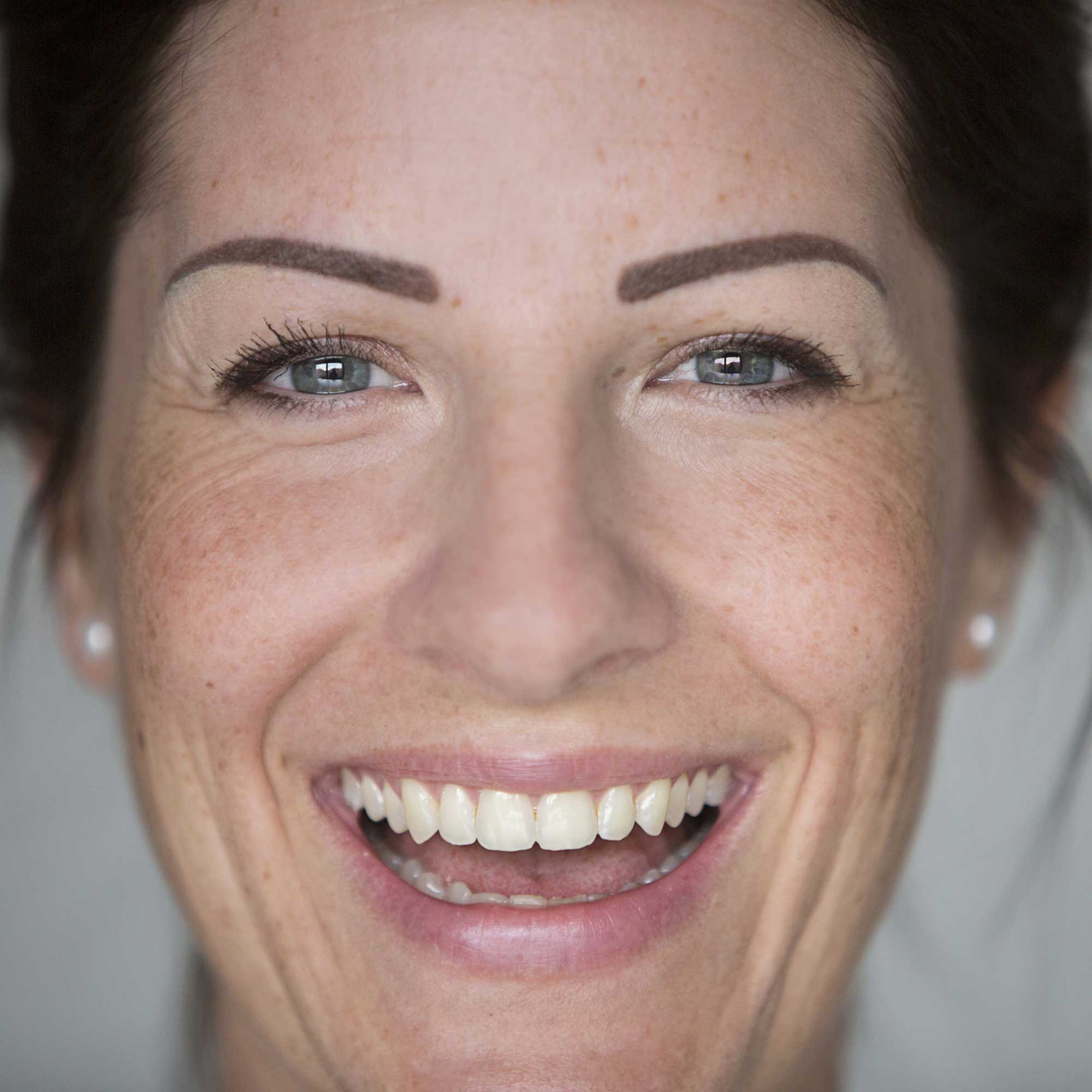 boots dark spot corrector