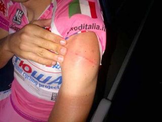 Joaquim Rodriguez (Katusha) shows his injury from hitting a barrier whilst checking the time trial course