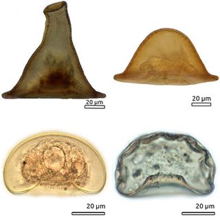 While the newfound Arcella gandalfi looks like Gandalf's hat (upper left), other amoebae from the Arcella genus look like other types of hats. Arcella brasiliensis (top right) is thought to be closely related to A. gandalfi. The amoebae Arcella intermedia (bottom right) and Arcella laevis (bottom left) show the diversity of shell shapes that these single-celled organisms can create.