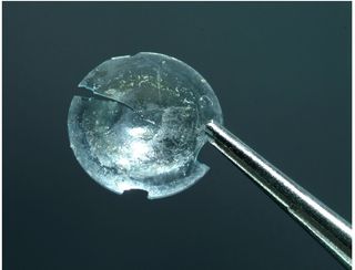 The hard contact lens, after it was surgically removed.