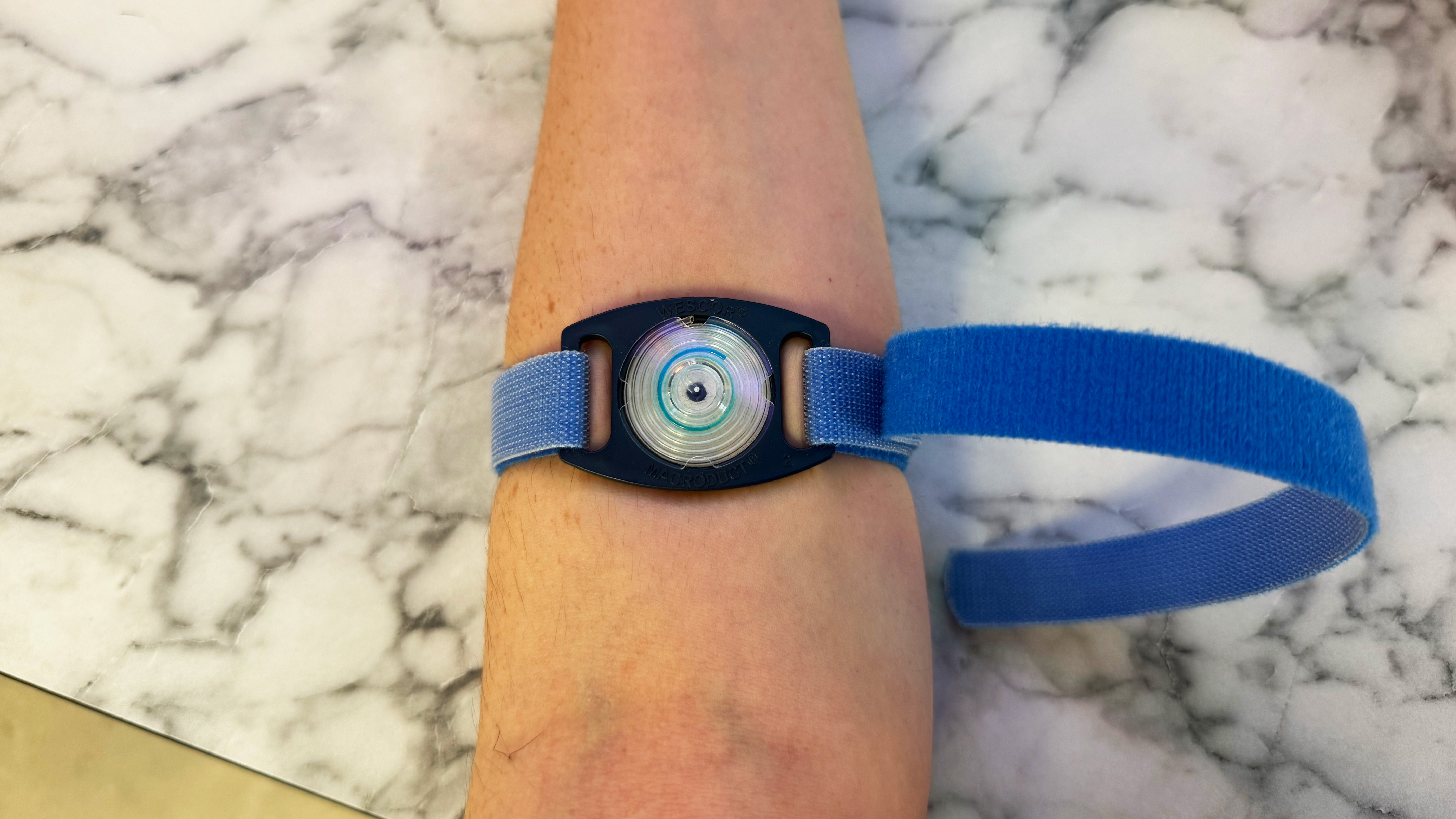 a photo of a sweat test being done